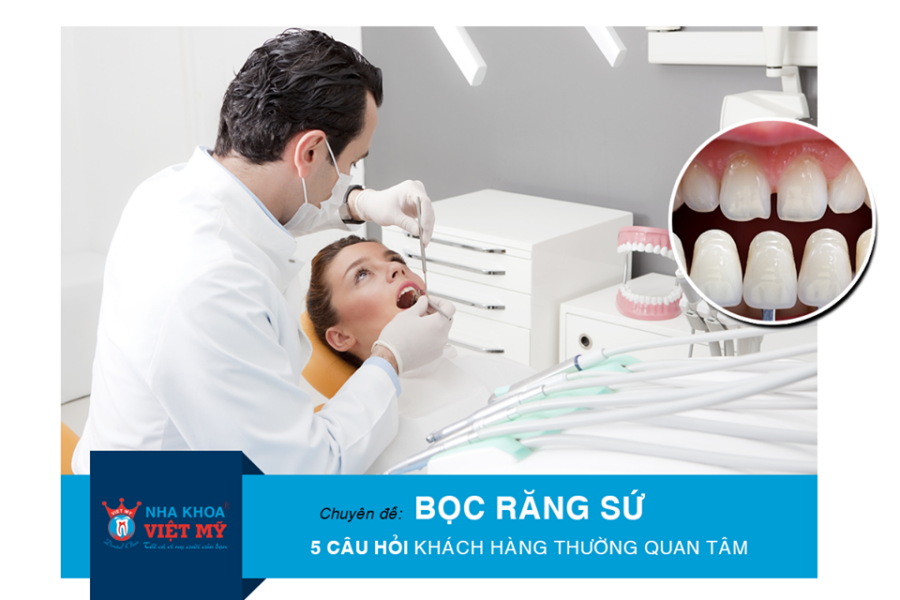 bọc rắng sứ