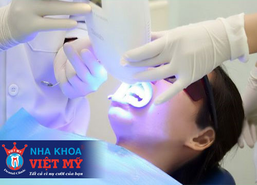 phòng khám nha khoa nhổ răng uy tín nhất tại Đà Nẵng