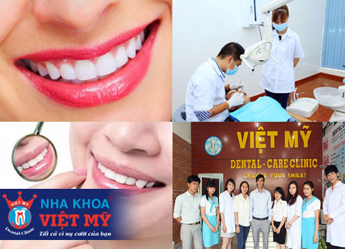 nha khoa nhổ răng và tẩy trắng răng tốt nhất tại Kiên Giang