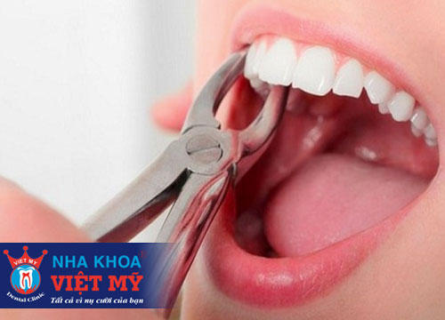 phòng khám nha khoa nhổ răng tốt nhất tại Sa Huỳnh