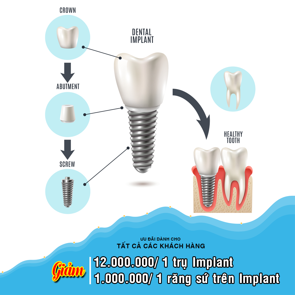 CHƯƠNG TRÌNH ƯU ĐÃI DÀNH CHO KHÁCH HÀNG N?MỪNG 8/3