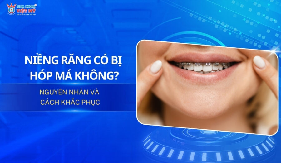 thumbnail niềng răng có bị hóp má không