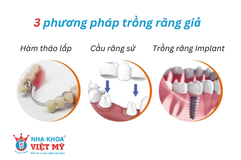 3 phương pháp trồng răng giả