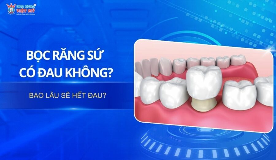 Thumbnail Bọc răng sứ có đau không? Bao lâu sẽ hết đau?