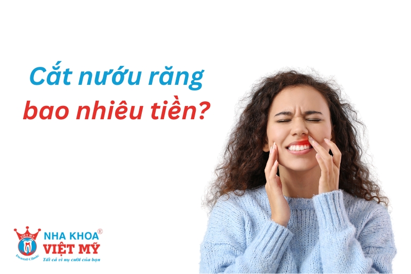 cắt nướu răng giá bao nhiêu tiền