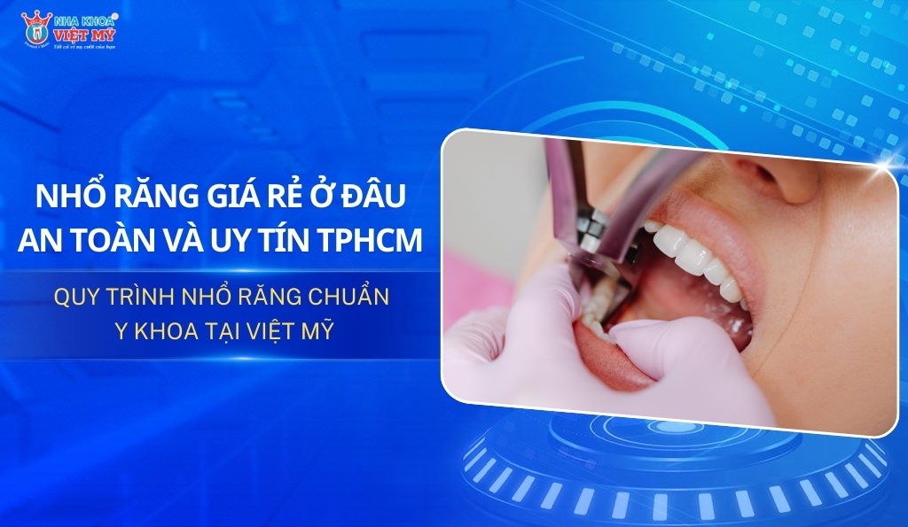 thumbnail nhổ răng giá rẻ ở đâu an toàn và uy tín tphcm