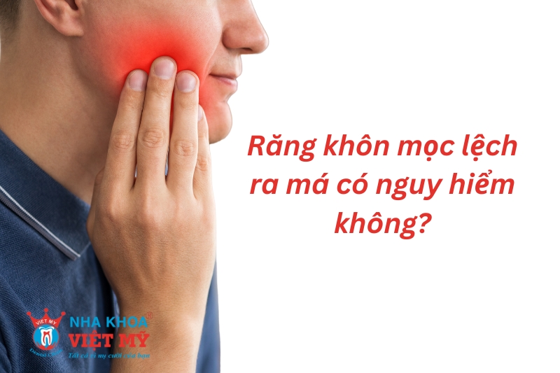 răng khôn mọc lệch ra má có nguy hiểm không