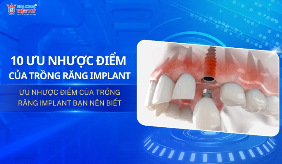 thumbnail ưu nhược điểm của trồng răng implant bạn nên biết