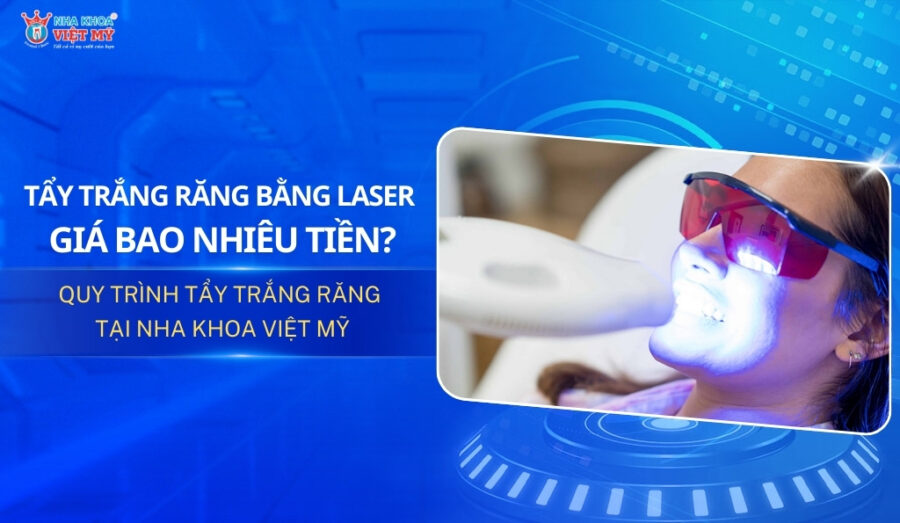 thumbnail tẩy trắng răng bằng laser bao nhiêu tiền