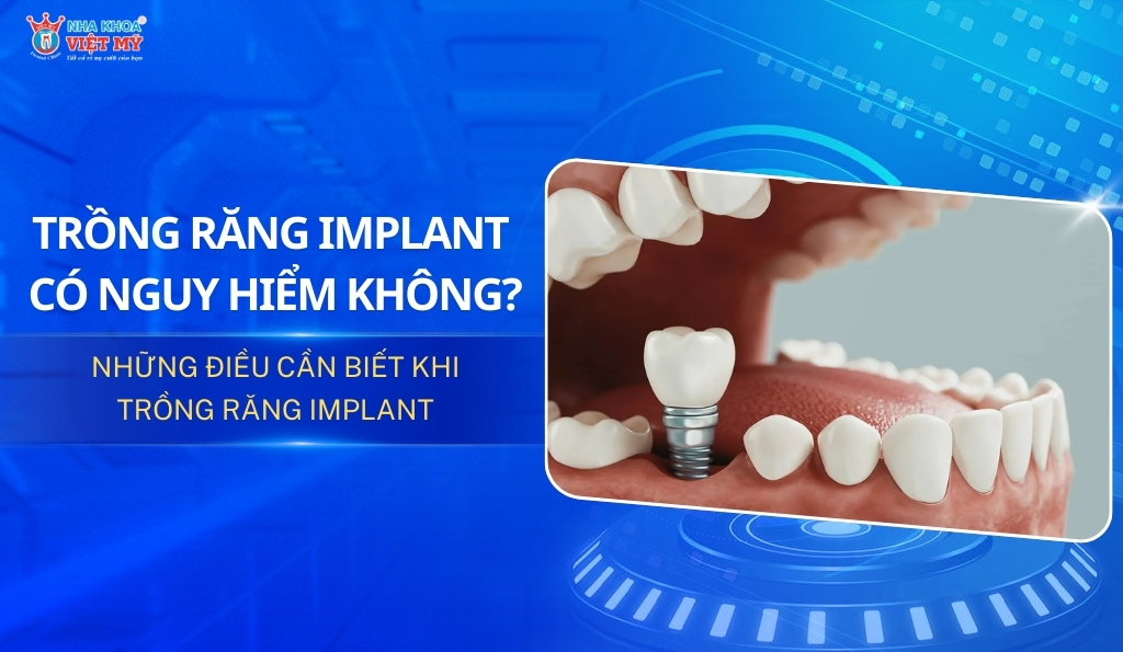 Thumbnail trồng răng có nguy hiểm không, những điều cần biết