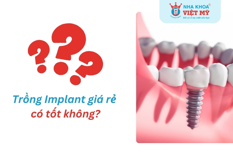 Trồng răng implant giá r?có tốt không