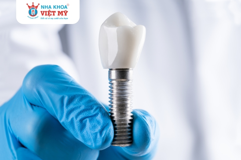 tr?răng implant tác động đến chi phí trồng răng implant