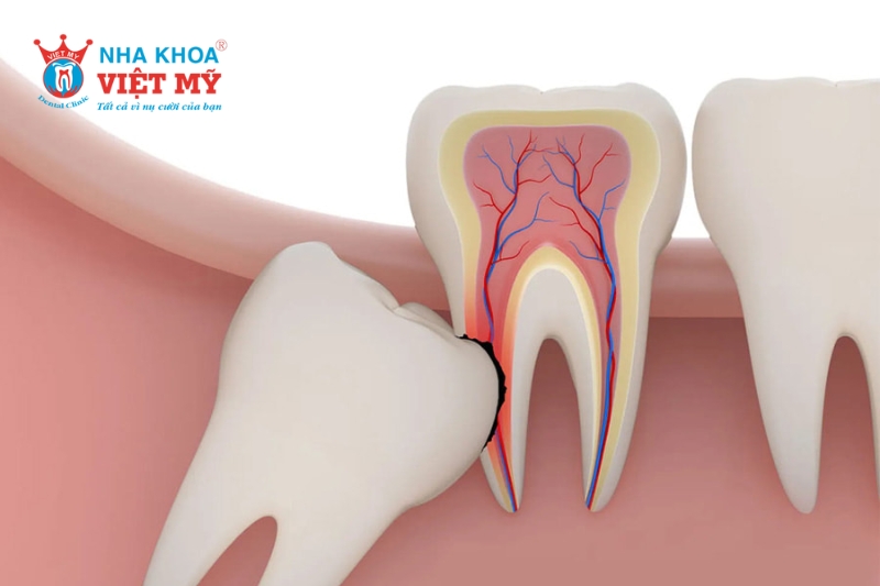 vị trí và đặc điểm của răng