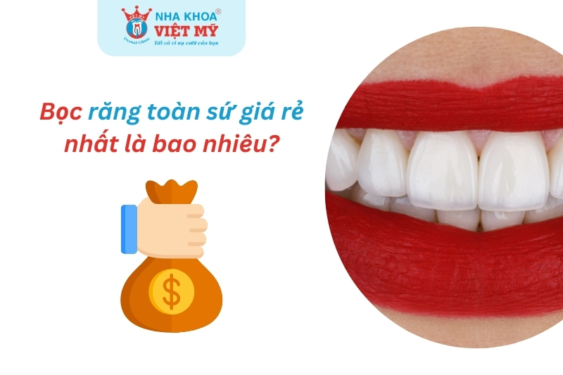 bọc răng toàn sứ giá rẻ nhất bao nhiêu tiền