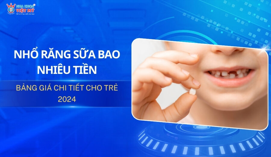 nhổ răng sữa bao nhiêu tiền thumbnail