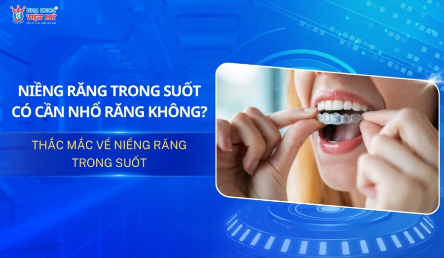 thumbnail niềng răng trong suốt có cần nhổ răng không