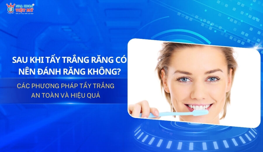 thumbnail sau khi tẩy trắng răng có nên đánh răng