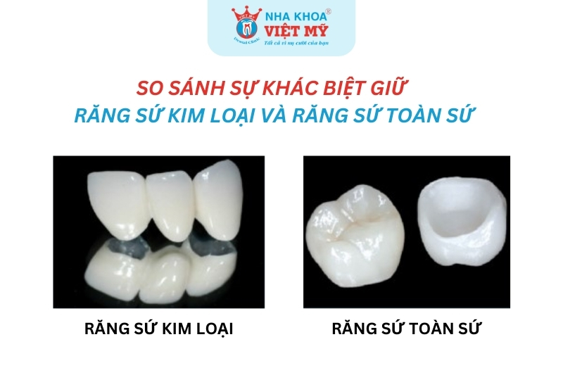 so sánh sự khác biệt khi bọc răng sứ kim loại và răng toàn sứ