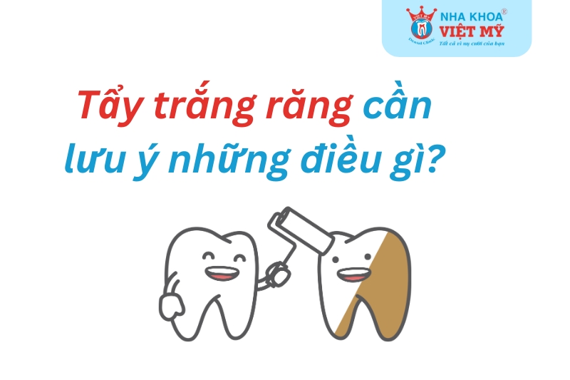 tẩy trắng răng cần lưu ý điều gì