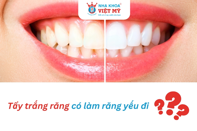 tẩy trắng răng có làm răng yếu đi