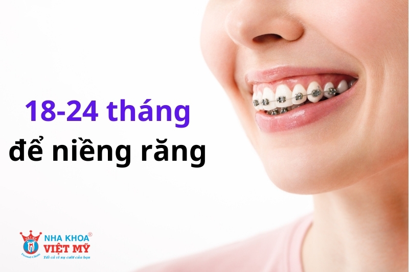 niềng răng bao lâu mới tháo ra được