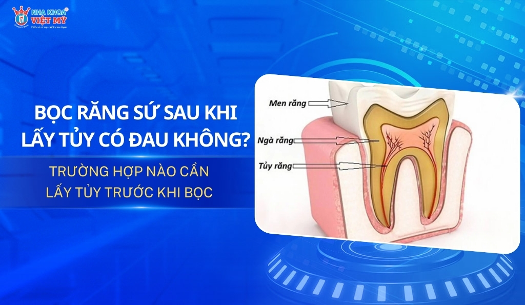 bọc răng sứ có đau không thumbnail