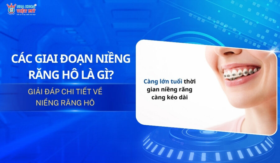 thumbnail các giai đoạn niềng răng hô là gì