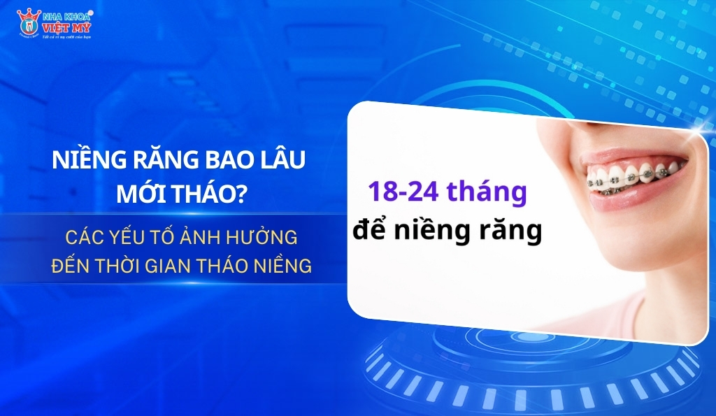 niềng răng bao lâu thì mới tháo thumbnail