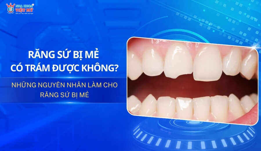 thumbnail răng sứ bị mẻ có trám được không