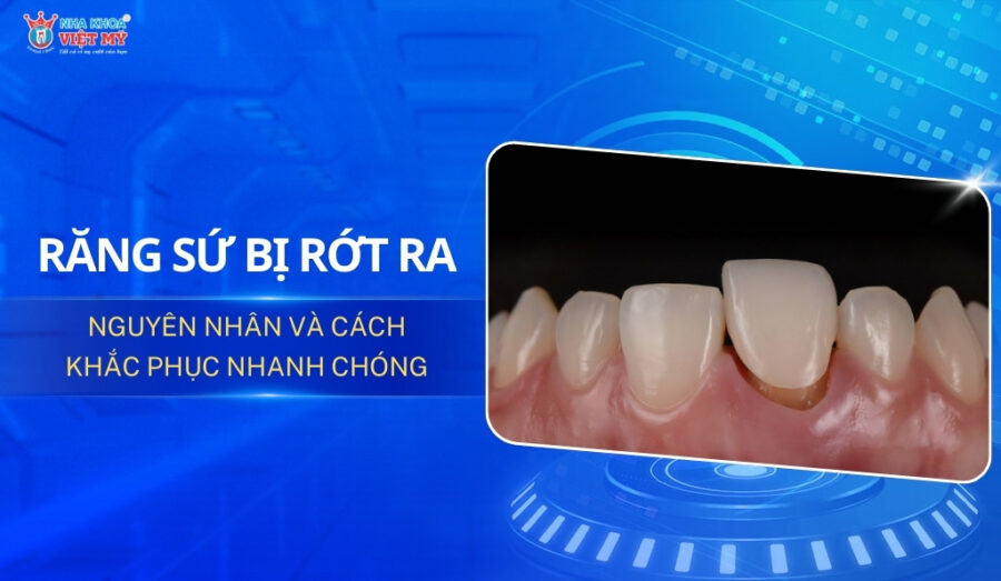 răng sứ bị rớt ra thumbnail