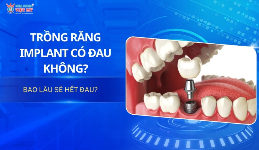 thumbnail trồng răng implant có đau không