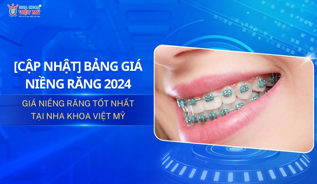 thumbnail bảng giá niềng răng