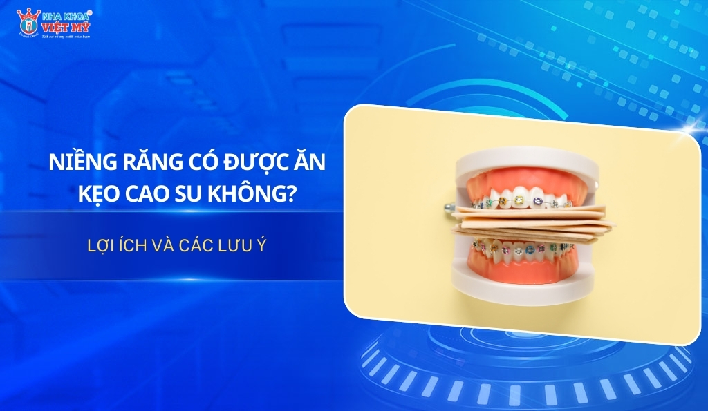 niềng răng có được ăn kẹo cao su không thumbnail