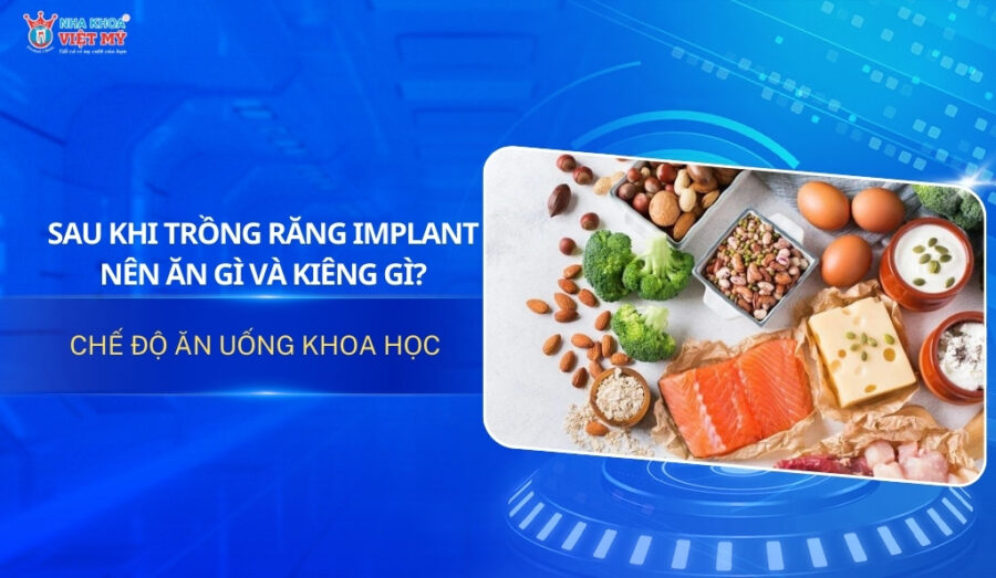 Thumbnail sau khi trồng răng implant nên ăn gì