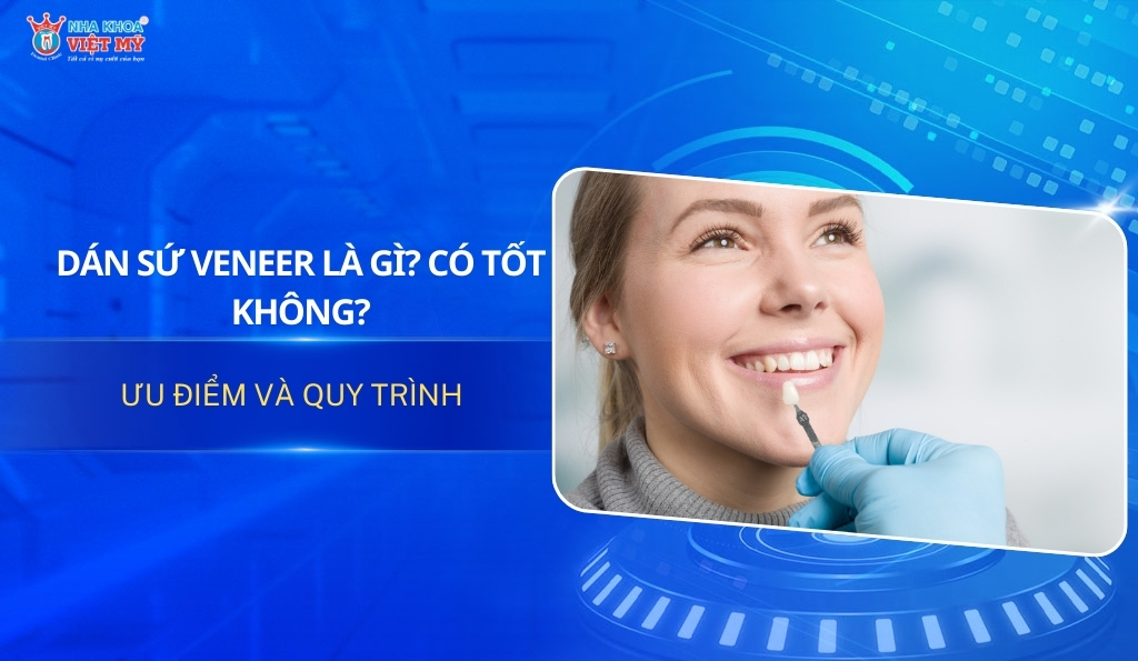 Thumbnail dán sứ Veneer là gì