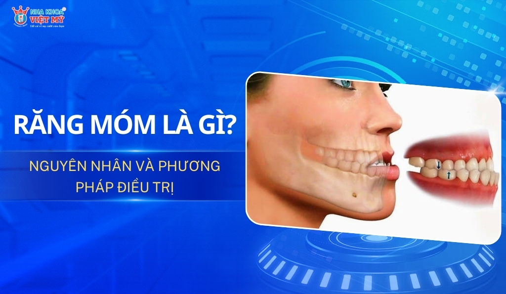 thumbnail răng bị móm là gì