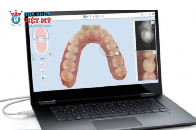 Scan răng 3D diễn ra nhanh chóng, không gây đau